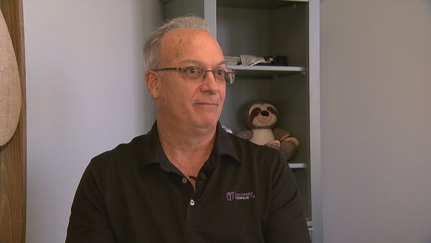 TONGUE TIE 6PKG.transfer_frame_1980 