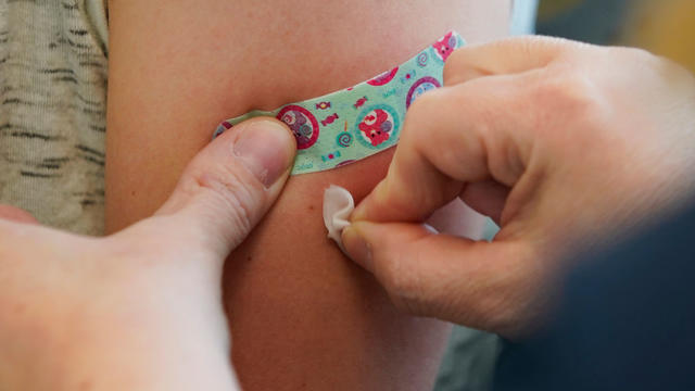 Global health officials say measles vaccinations have declined 