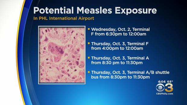 airport measles 