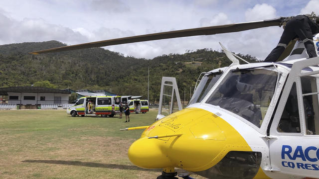 CORRECTION Australia Shark Attack 