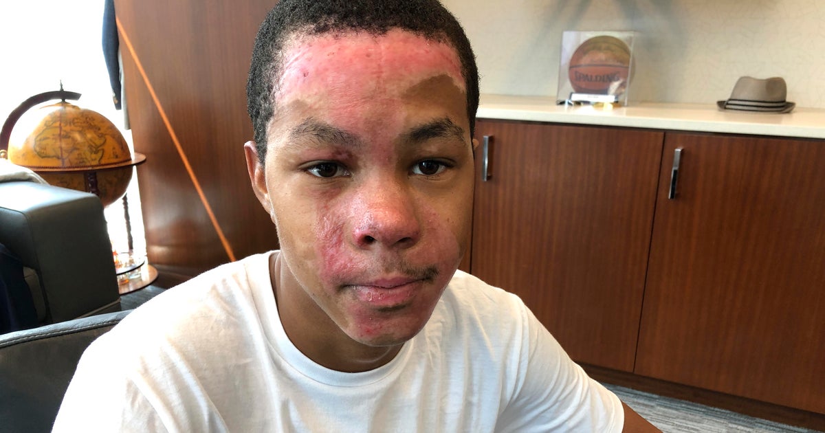 Chemistry teacher "froze in pure shock" after botched experiment injured teen at Redan High ...