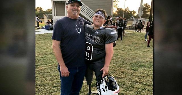 14-year-old double amputee pursuing his football dreams