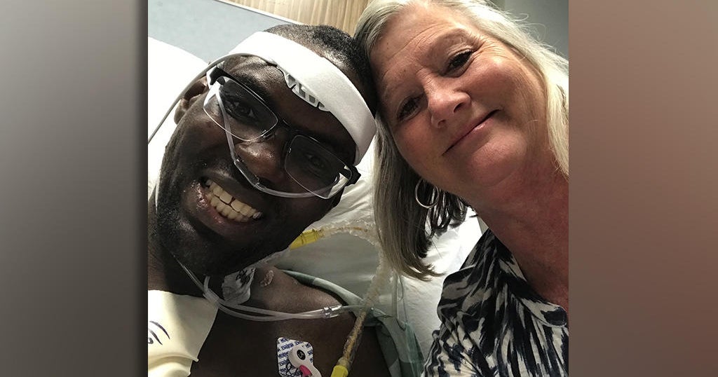 Nurse takes in man with autism so he can get a new heart CBS News