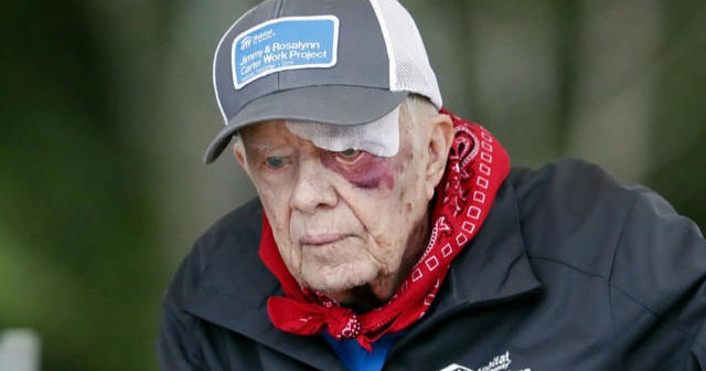 Risks of former President Jimmy Carter's operation for brain pressure