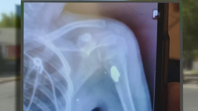 STOCKTON GIRL BULLET ARM 