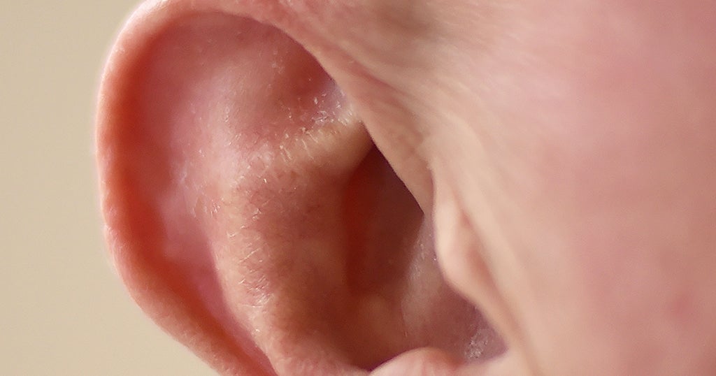 Water Trapped In Your Ears? Don't Shake Your Head To Get It Out