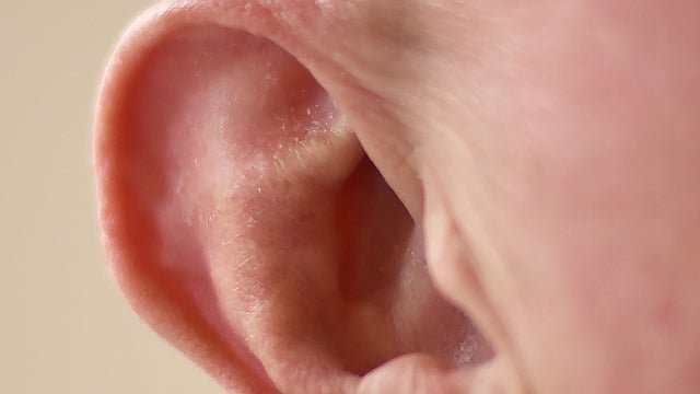 ear.jpg 