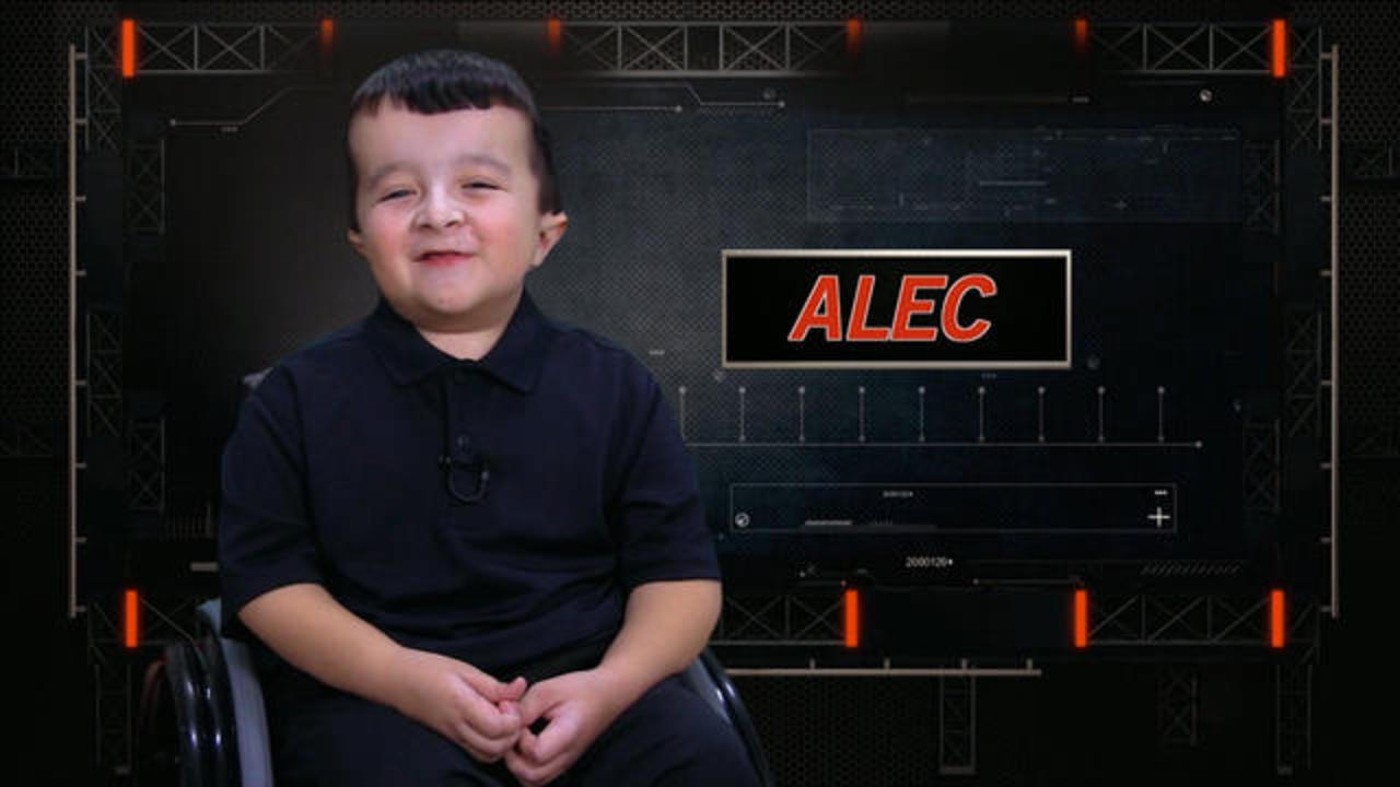 what is wrong with alec from shriners hospital