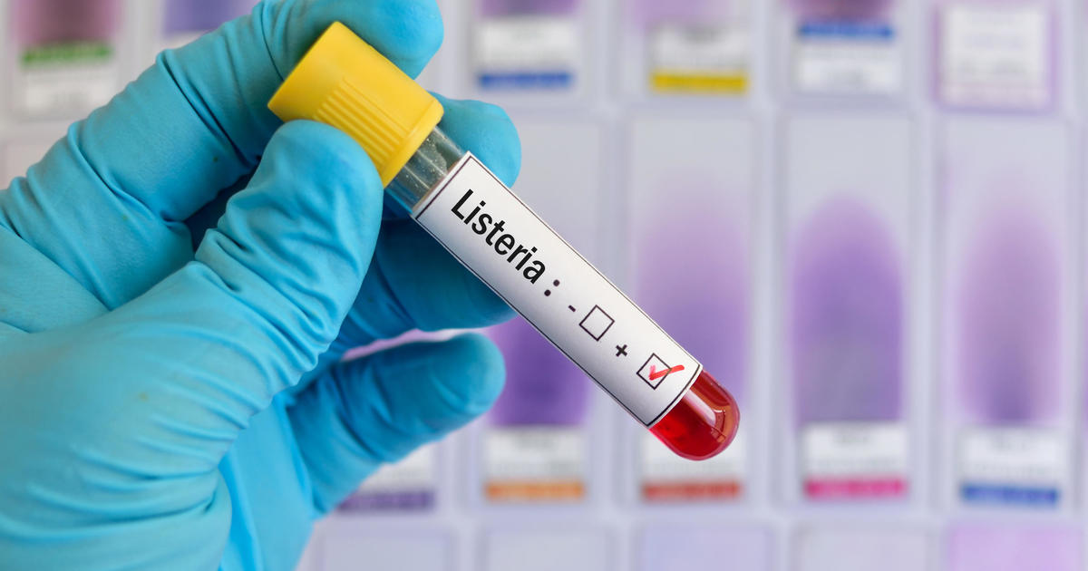 CDC: Listeria outbreak linked to Florida