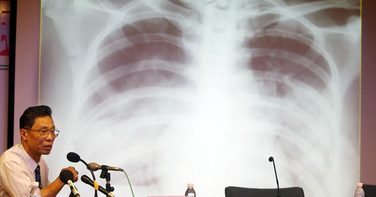 Mystery pneumonia outbreak in China sparks fear of deadly SARS virus