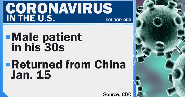 First U.S. case of deadly coronavirus diagnosed in Washington state ...