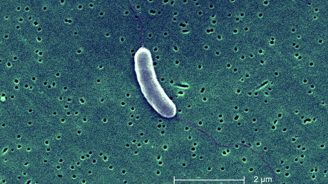 Vibrio Vulnificus 