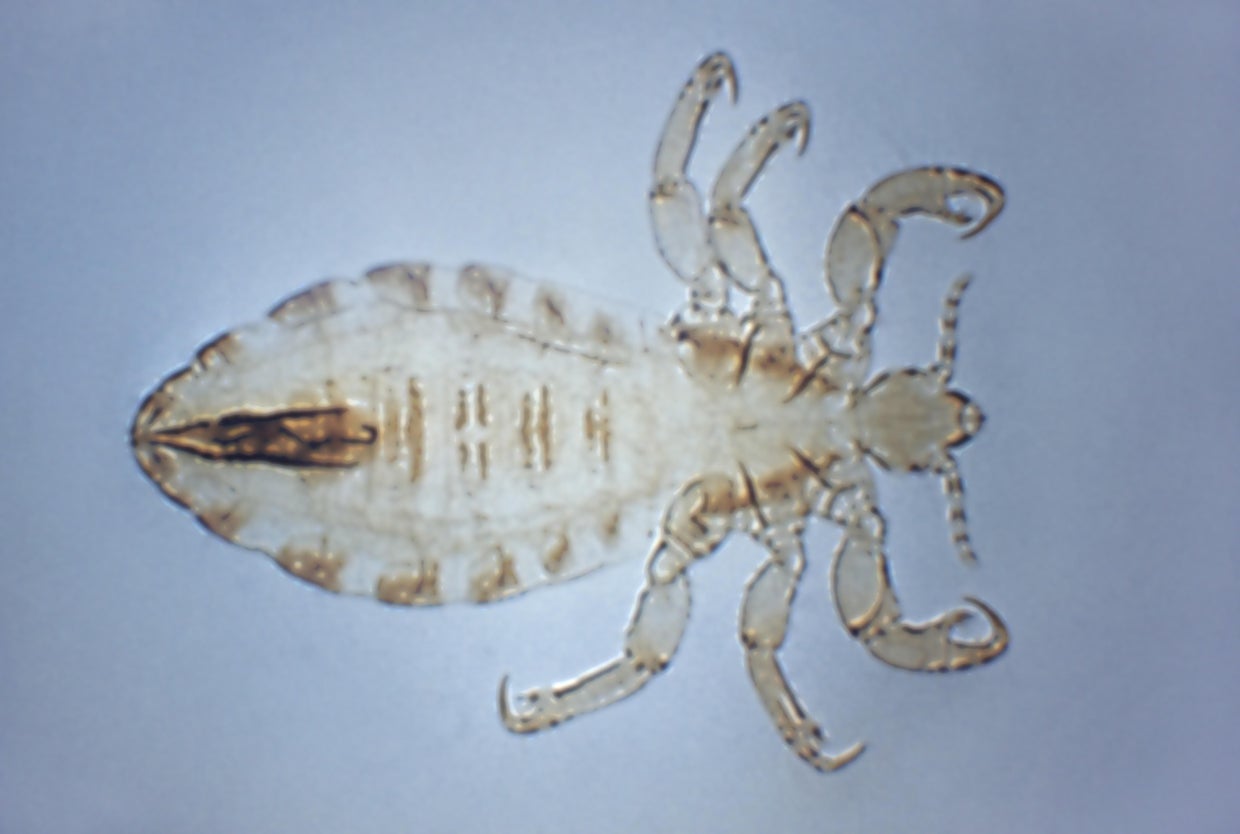 Body Louse
