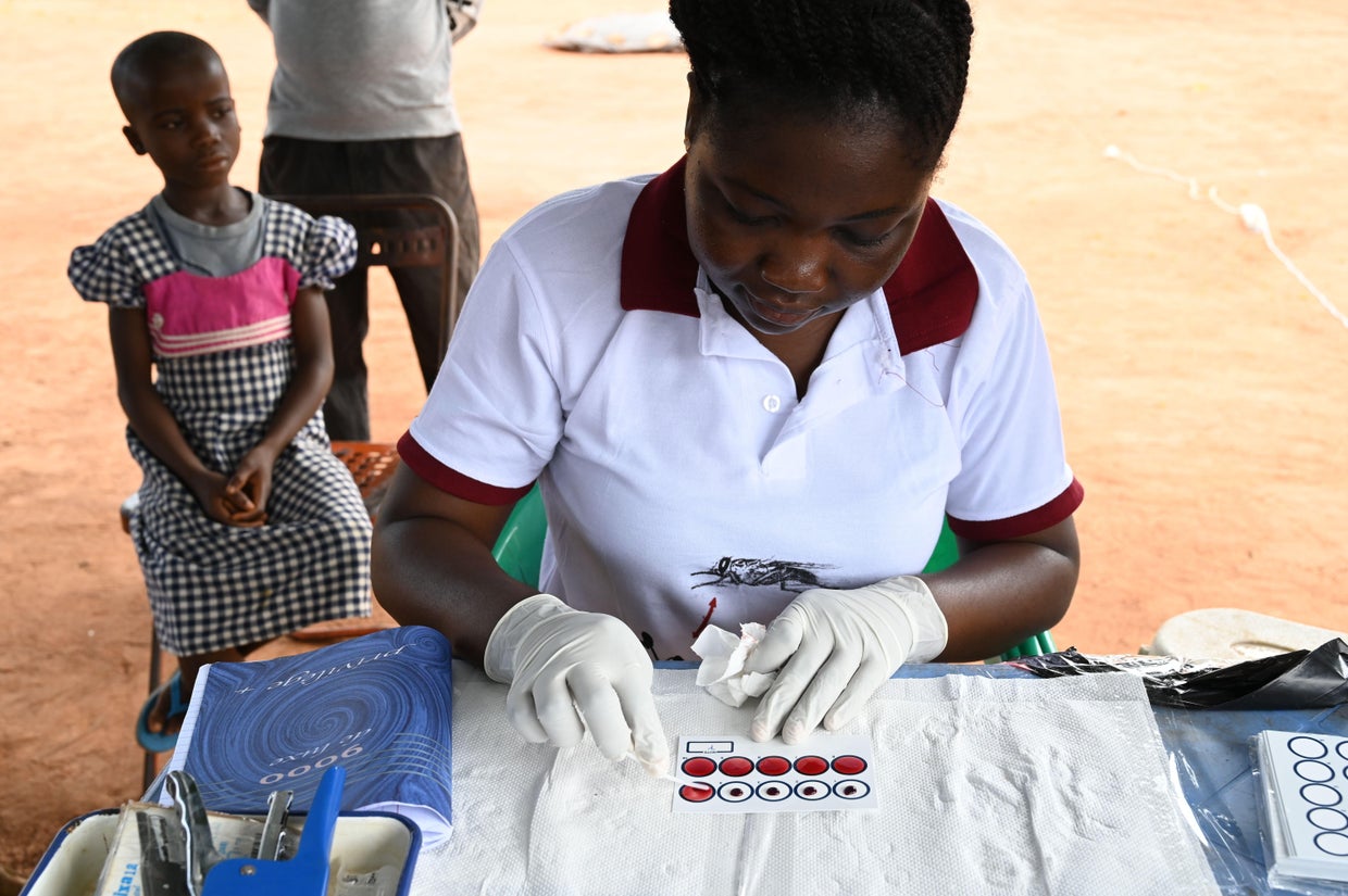 ICOAST-HEALTH-SLEEPING-SICKNESS