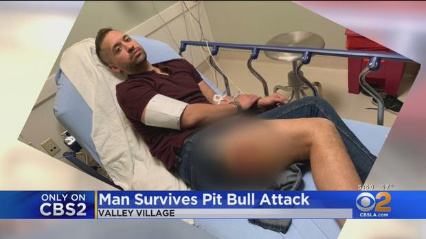 Matthew Gutierrez Attacked By Pit Bull 