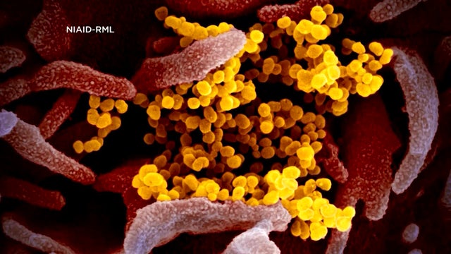 Coronavirus-330PM-PKG-Bacchus-THU0176-1.jpg 