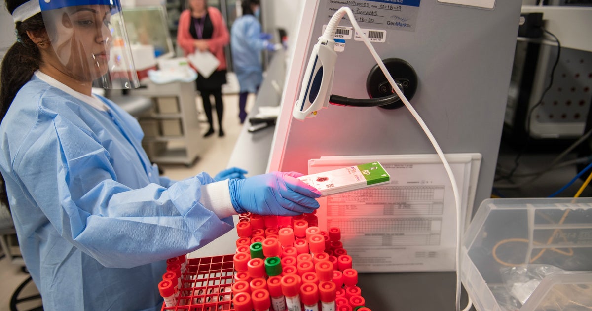 Coronavirus Update Northwell Health Labs On Long Island Gets Approval