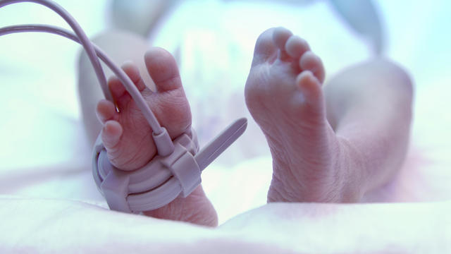 Feet of new born baby under ultraviolet lamp 