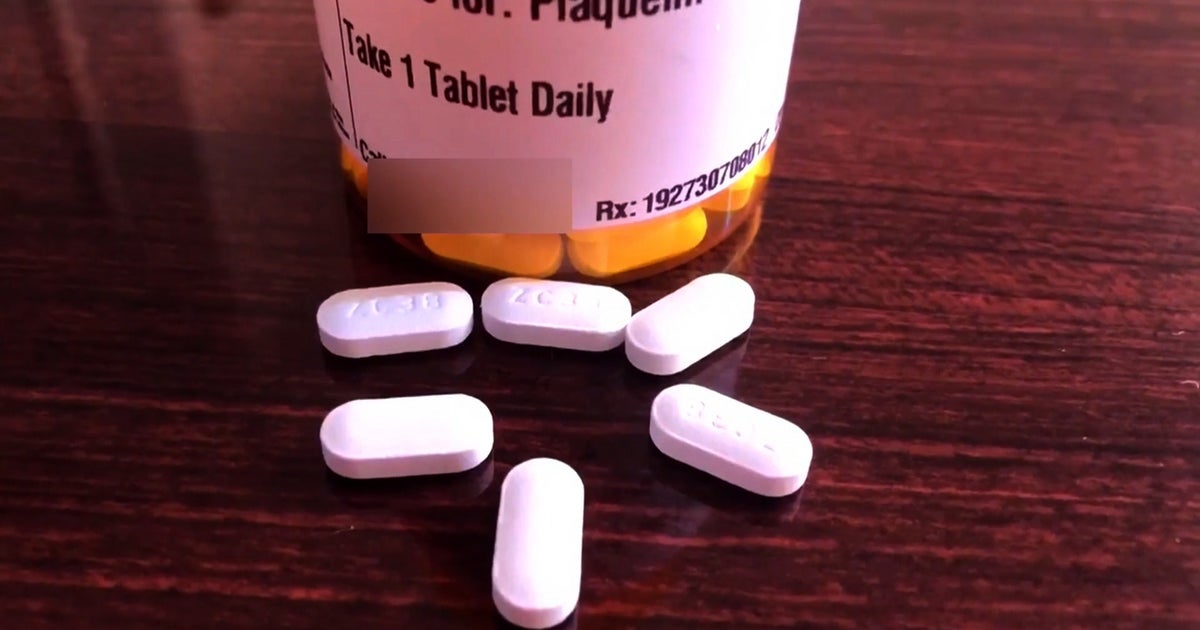 What Is Hydroxychloroquine? CBS Minnesota