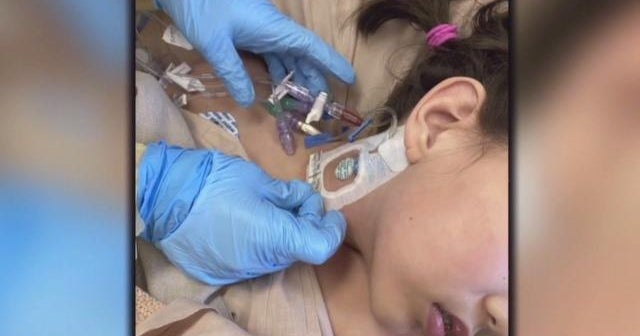 Medical community digs into "pediatric inflammatory multi-system syndrome" - CBS News