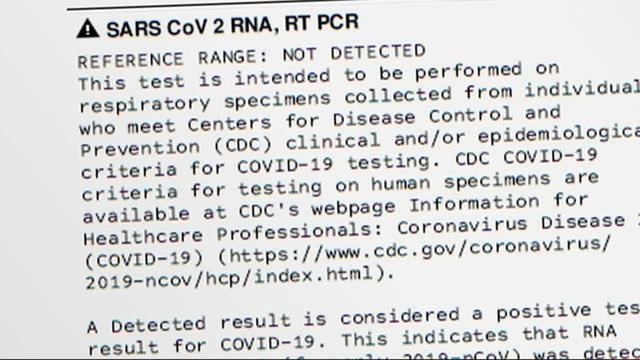 antibody-test-1.jpg 