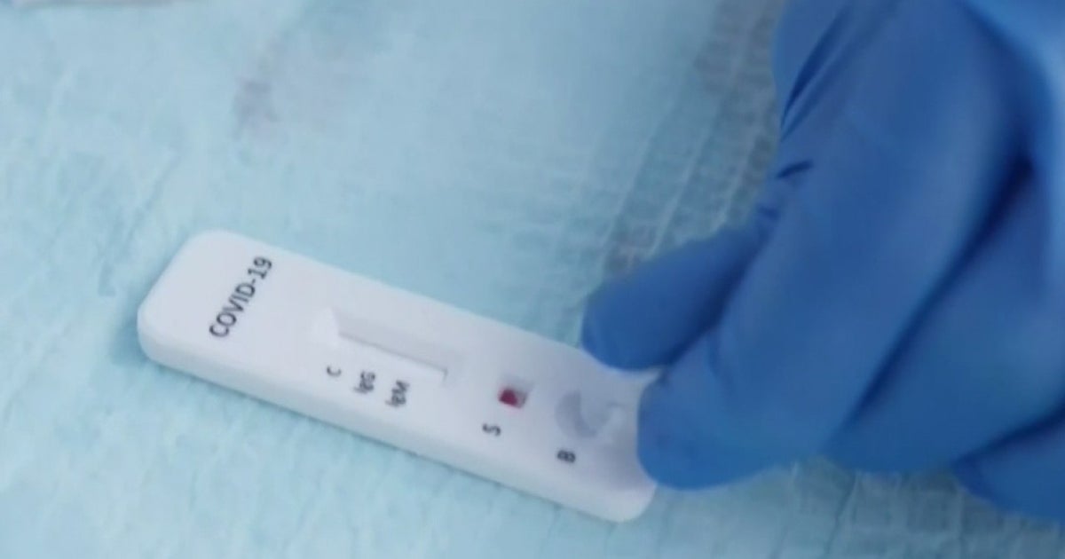 Doctors See Surge In Requests For Coronavirus Antibody Tests CBS Sacramento