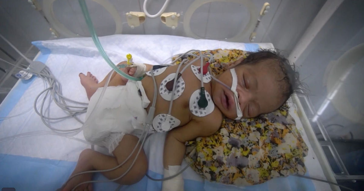 48,000 Yemeni women could die giving birth as UN starts shutting down