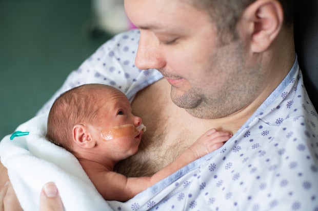 Father taking care of his premature baby doing skin to skin at hospital