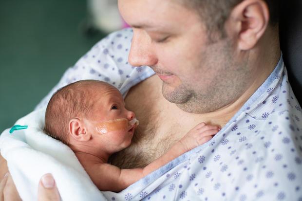Father taking care of his premature baby doing skin to skin at hospital 