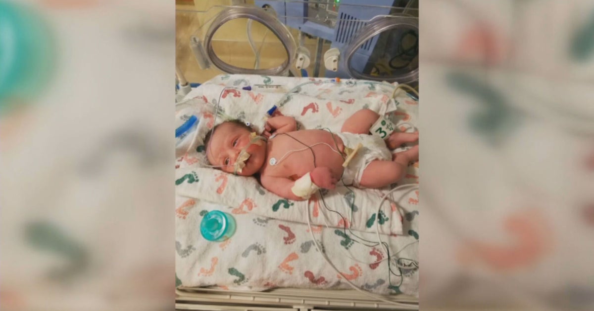 'We Weren't Going To Give Up': Family Celebrates Progress Of 1-Year-Old ...