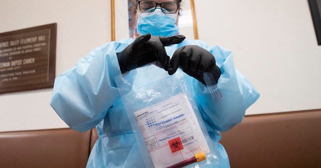 COVID19 antibody testing explained CBS News