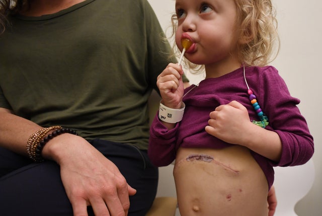 Transplant from mother 