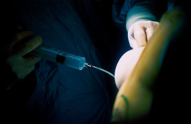 Plastic Surgery On Breast 