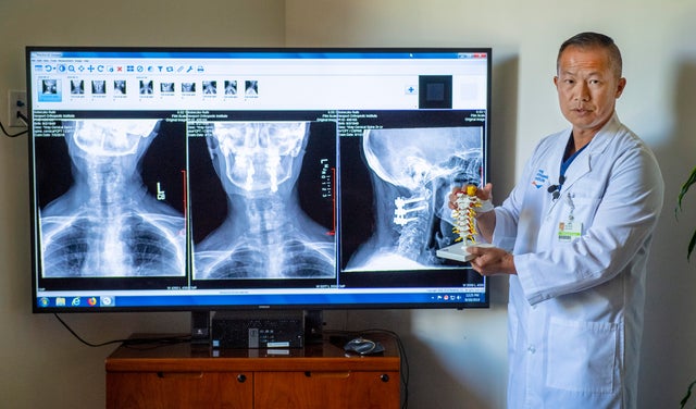 Huntington Beach woman had her skull detached from skeleton to fix fractured neck 