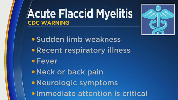 Acute Flaccid Myelitis 