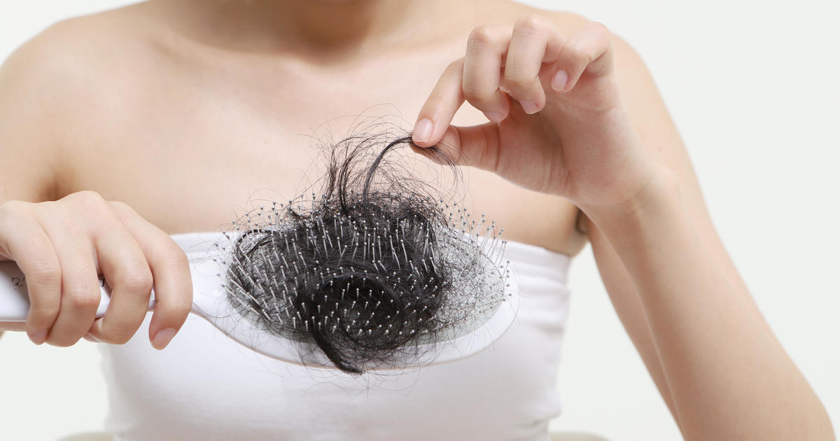 COVID-19 could cause your hair to fall out - CBS News