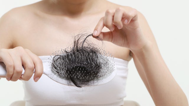 Woman holding hairbrush with lost hair 