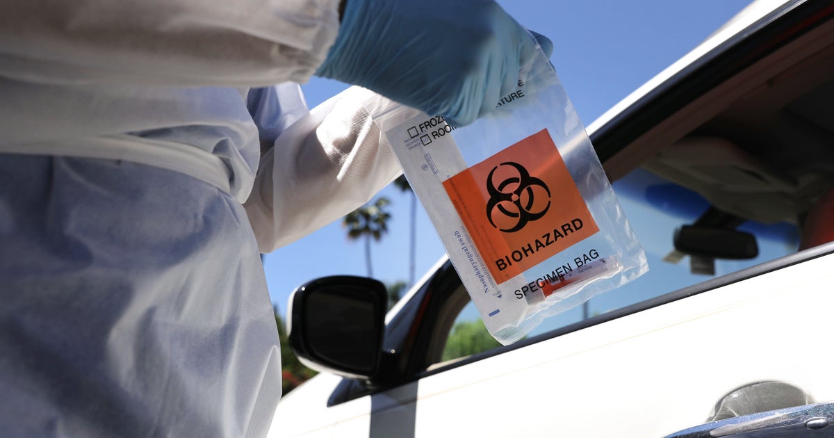 Orange County Reports 287 Additional COVID-19 Cases, 5 More Deaths ...