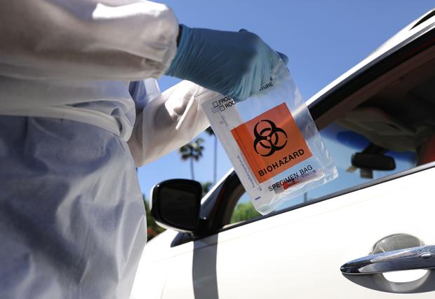 COVID-19 Testing Continues In LA County As CA Reports 12,500 New Cases In 24 Hours 