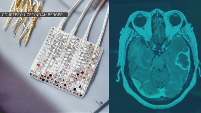 brain-implant.jpg 
