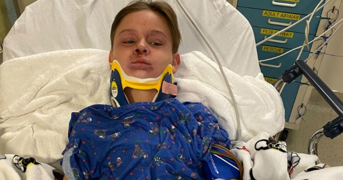 Bedford Boy Recovering After Being Choked By Seat Belt - CBS Boston