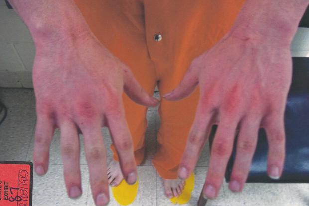Mark Howerton's hands 