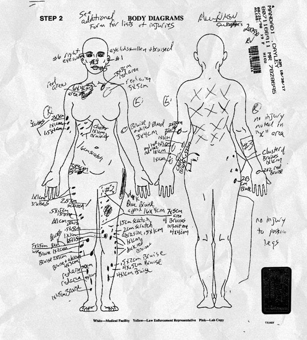 mandadi-autopsy.jpg