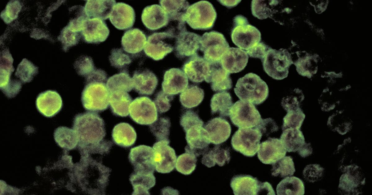 Texas city declares disaster after brain-eating amoeba found in tap water