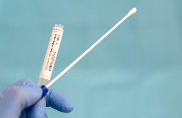 coronavirus COVID-19 test Cotton swab and test tube for Coronavirus test (COVID-19)), macro image of medical equipment in hands of healthcare professional 