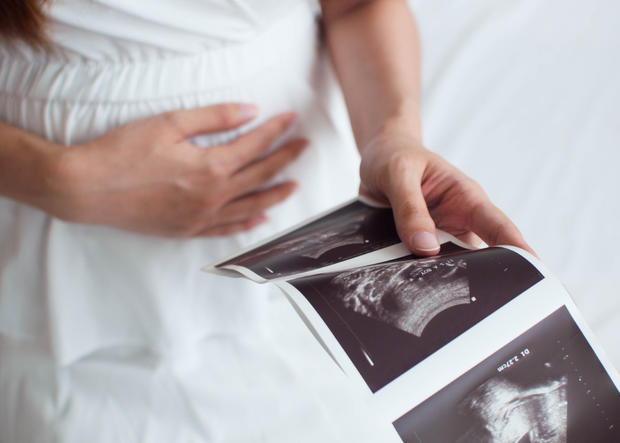 pregnant ultrasound abortion pregnancy 