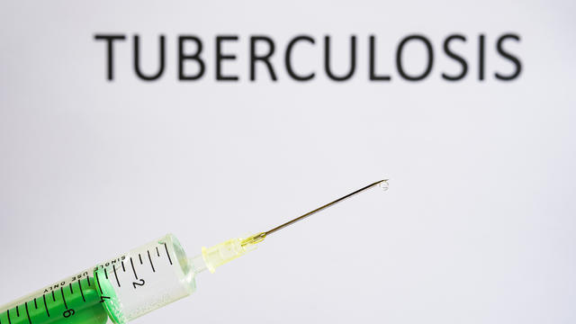 tuberculosis-vaccine.jpg 