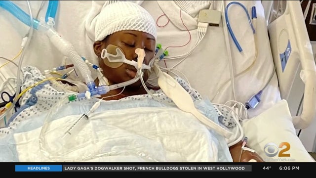 dana-smith-liver-transplant-nose-piercing-infection-gusoff.jpg 