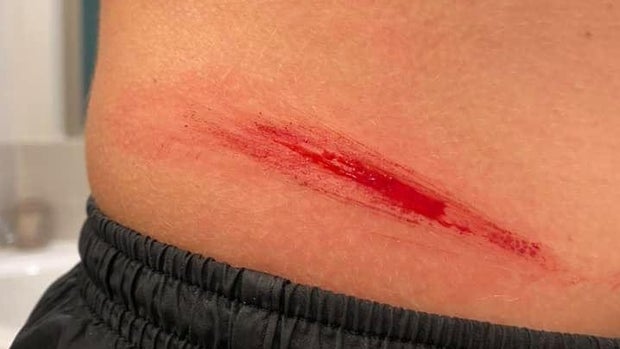 Fort Worth Oakmont Park Attack