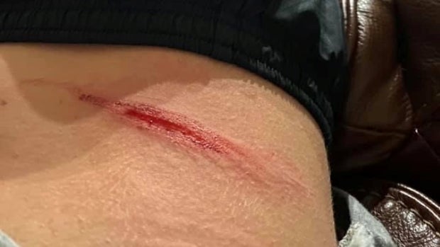 Fort Worth Oakmont Park Attack